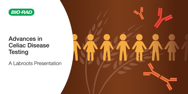 Advances in Celiac Disease Testing: From method validation to serological diagnosis