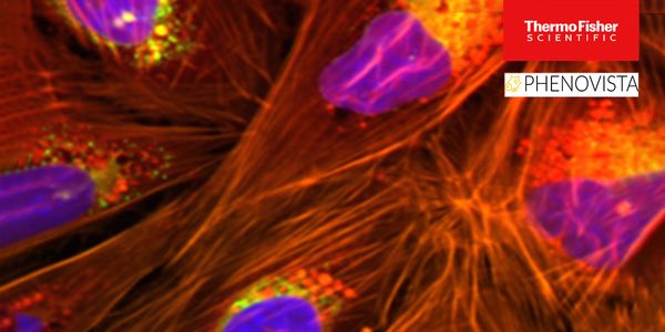 Practical Considerations for Designing and Executing High-content Screens