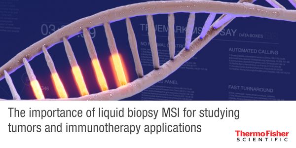 The importance of liquid biopsy MSI for studying tumors and immunotherapy applications