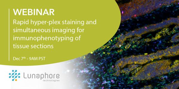 Rapid hyper-plex staining and simultaneous imaging for immunophenotyping of tissue sections.