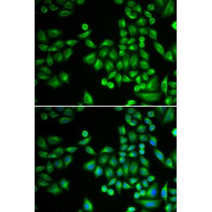 Anti-PTPN1 antibody