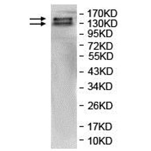 Anti-SMARCA2 / BRM antibody [EPR23103-44](AB240648)