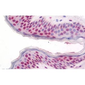 Anti-Periostin antibody(AB14041)