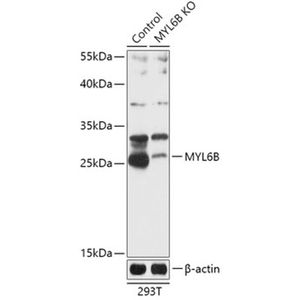 Anti-MYL6B antibody