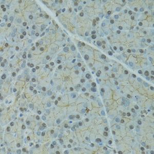 Anti-SERPINF2 antibody