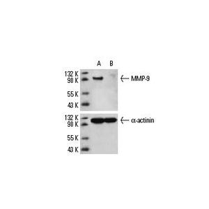 MMP-9 siRNA (h)