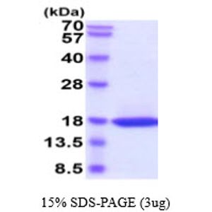 Recombinant Human ADIPOQ Protein, His-tagged