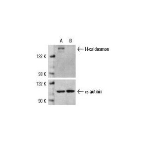 Caldesmon siRNA (h)