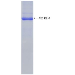 Recombinant Human ABHD3 protein, His-tagged
