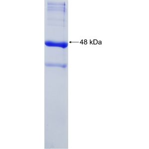 Recombinant Human ALB protein, His-tagged