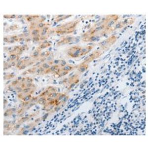 TMRE-Mitochondrial Membrane Potential Assay Kit(AB113852)