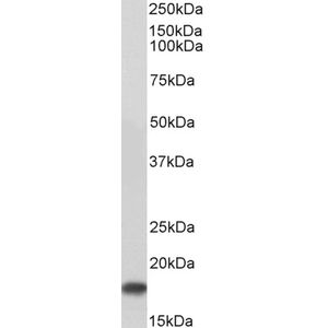 Superoxide Dismutase Activity Assay Kit (Colorimetric)(AB65354)