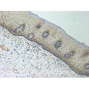 Anti-beta Synuclein antibody [EP1537Y] - BSA and Azide free(AB221908)