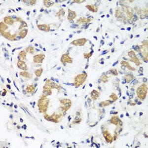 Anti-OXCT1 antibody