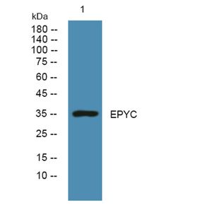 Anti-EPYC antibody