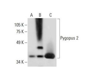 Pygopus 2 (B-8) | Science Company | Labroots