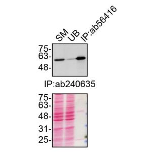 Anti-SQSTM1 / p62 antibody [2C11] - BSA and Azide free