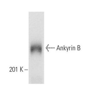 Ankyrin B (2.20) AC
