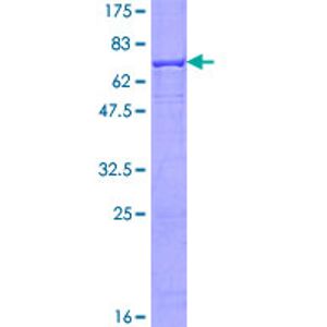Recombinant Human ALKBH1 Protein, GST-tagged