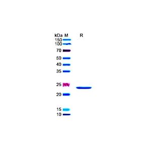 Recombinant Human A1CF Protein (Gly389-Arg587), N-His-tagged