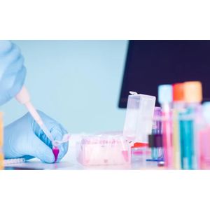 "Human Papilloma virus-HPV-33,51, 52 and 58 Real-Time PCR"