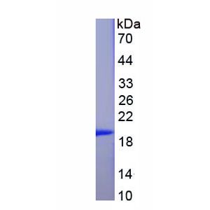 Recombinant Human ADORA2B protein, His-SUMO-tagged
