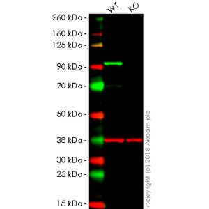 Anti-N Cadherin antibody - Intercellular Junction Marker(AB18203)