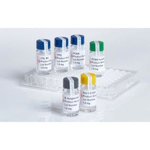 Bartonella henselae 17 kDa