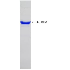Recombinant Human ALK protein, His-tagged