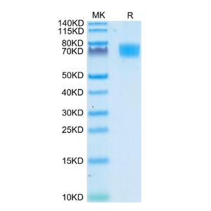 Recombinant Human ALCAM protein, His-tagged
