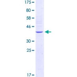 Human Progranulin ELISA Kit(AB252364)