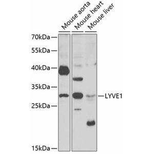 Anti-LYVE1 antibody