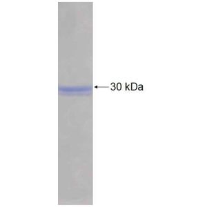 Recombinant Human AK3 protein, His-tagged