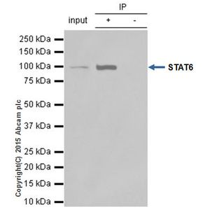 Anti-STAT6 antibody [YE361]