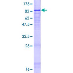 Anti-HMGB1 antibody [EPR3507](AB79823)
