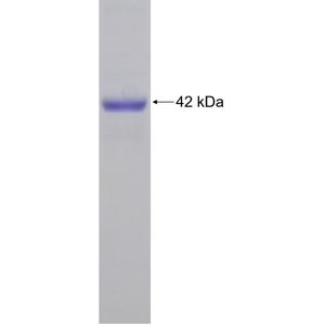 Recombinant Human AARS protein, His-tagged