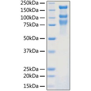 2019-nCoV S1+S2 ECD (S-ECD) Protein