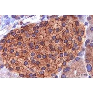 Anti-iNOS antibody [EPR16635](AB178945)