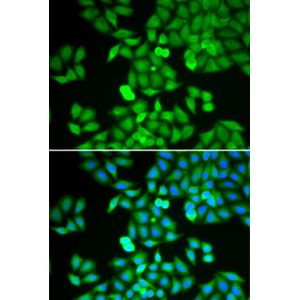 Anti-ARHGDIA antibody