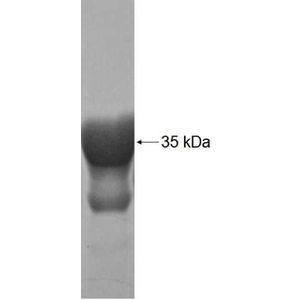 Recombinant Human AKAP7 protein, GST-tagged