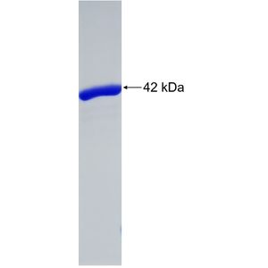 Recombinant Human AHNAK protein, GST-tagged