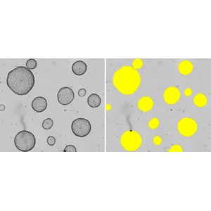 Incucyte® Organoid Analysis Software Module
