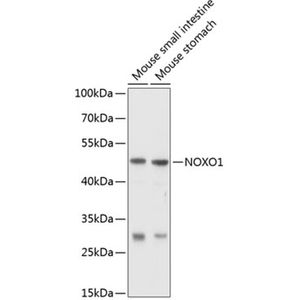 Anti-NOXO1 antibody