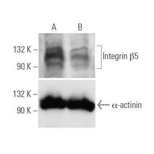 Integrin β5 siRNA (h)