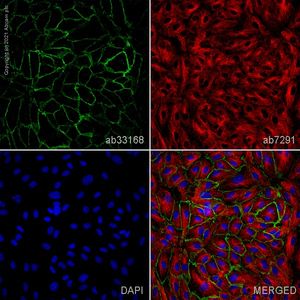 Anti-VE Cadherin antibody - Intercellular Junction Marker