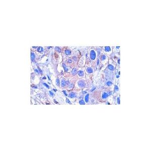 CD38 (AT1) Alexa Fluor® 546