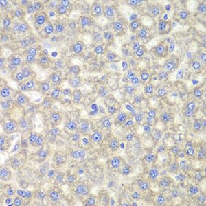 Anti-EYA3 antibody