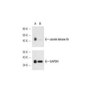 casein kinase Iδ siRNA (h)