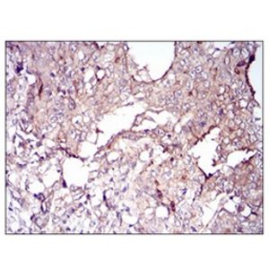 Anti-Cardiac Troponin I antibody(AB47003)