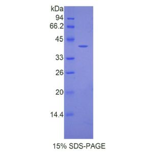 Recombinant Mouse AngIII protein, His-GST-tagged